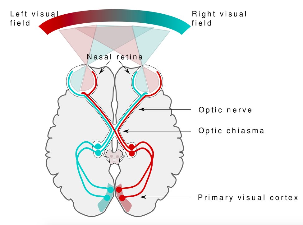 Իլոն Մասկ. Neuralink-ը կթողարկի տեսողությունը վերականգնող պրոդուկտ